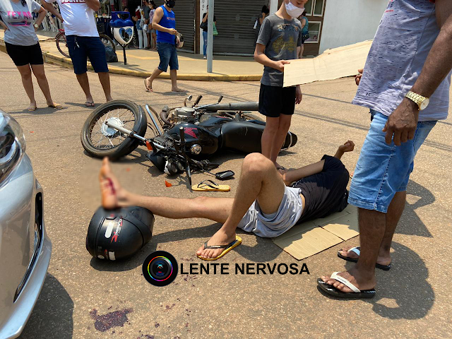 Motociclista sofre grave ferimento em acidente na Avenida Jatuarana 12 Motociclista sofre grave ferimento em acidente na Avenida Jatuarana