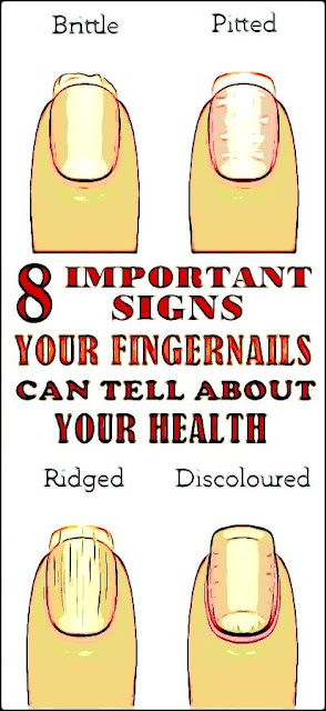 8 Important Signs Your Fingernails Can Tell About Your Health - Healthy ...
