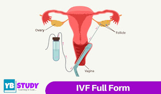 IVF Full form : Detail information about IVF