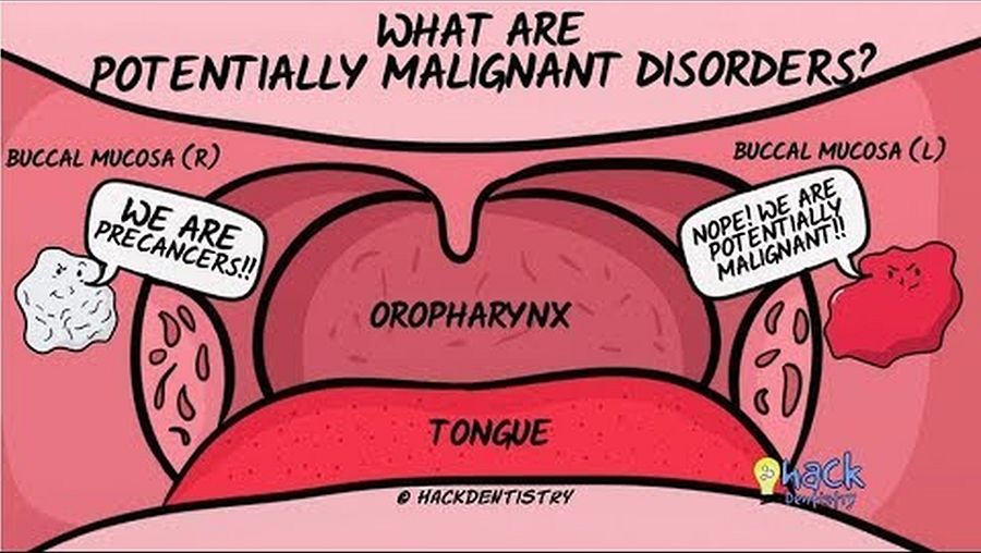 ORAL MEDICINE: What are Oral Potentially Malignant Disorders? - Odonto-Tv