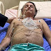 URGENTE - Cirurgia foi descartada e Bolsonaro receberá tratamento clínico, diz boletim