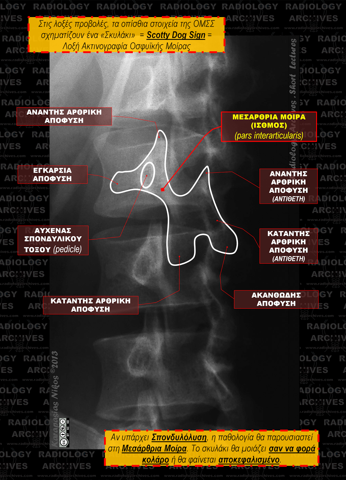 Radiology Archives Short Lecture n.1 Scotty Dog Sign