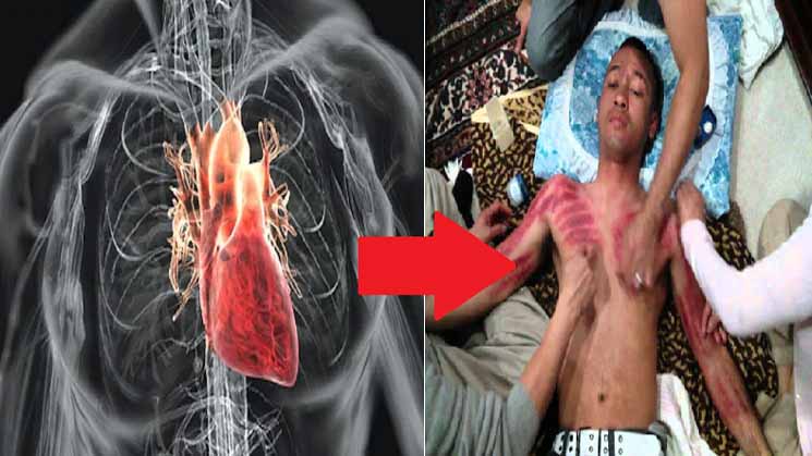 Berikut Ini Ciri Ciri Masuk Angin Pembawa Maut Angin Duduk Dan Cara Mengobatinya Sehat Pedia Viii