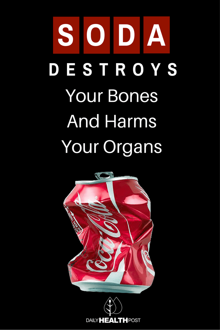 How to get caffeine without soda How to Quit Caffeine. In this Article: Article Summary Preparing to Stop Quitting Slowly Recovering from Caffeine Cravings Increasing Your Energy Without Caffeine Community Q&A 11 References Caffeine can help us feel more awake and alert, but too much for too long can be bad for your health. Quitting caffeine to reset your body and move away from the highs and lows of caffeine can be difficult.