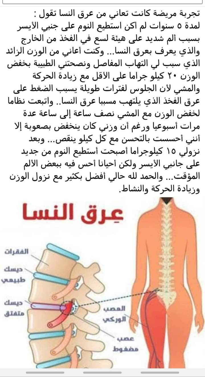 اسباب مرض عرق النسا