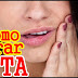 Como curar Afta rapidamente com remédio caseiro