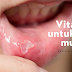 Vitamin Shaklee Untuk Ulser Mulut  