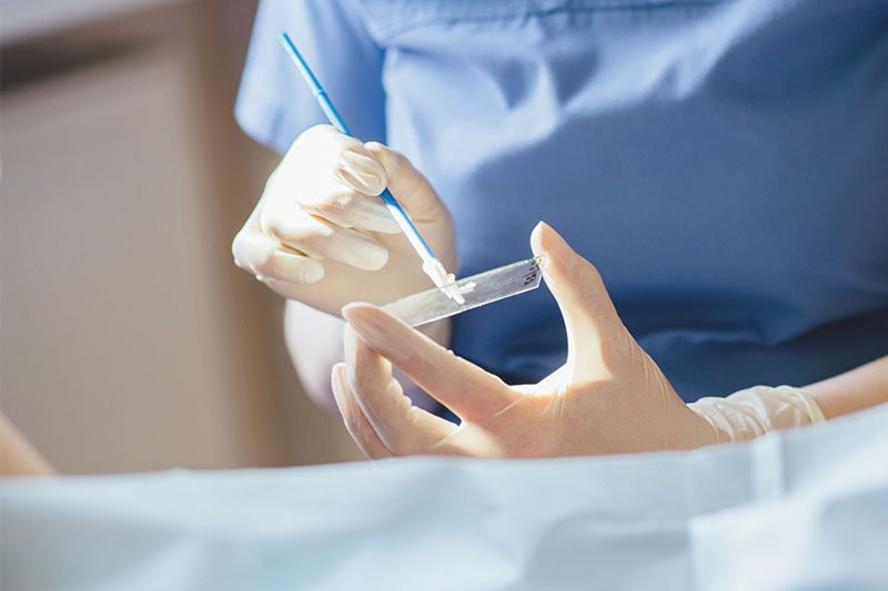 ob-gyn-updated-could-modified-paptest-help-detect-endometrial-and