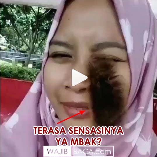 Lihat Ekspresinya, Wajah Wanita ini Digeliati Ulat Bulu, 