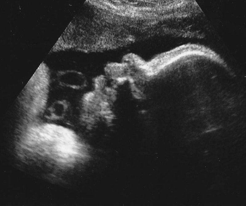 The Spamdrew Family Big Baby Boy Ultrasound