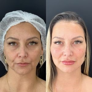 Blog Jornal da Mulher: Com o desejo de rejuvenescer, os