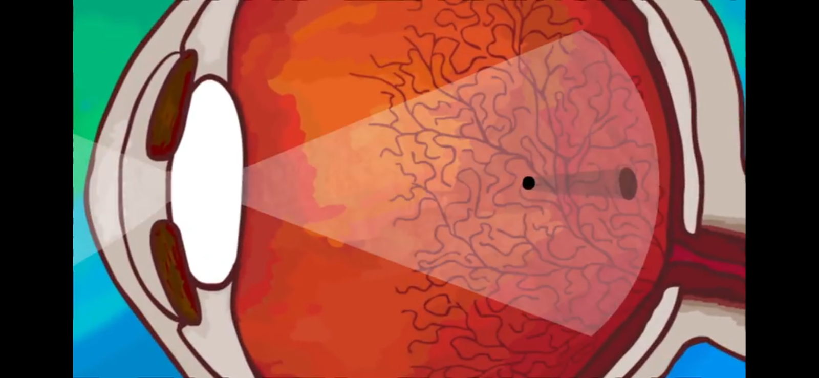 Снег в глазах. Зимний глаз. Картина глаза. Лопнул капиляр в галзу. Волна в глазу что это.