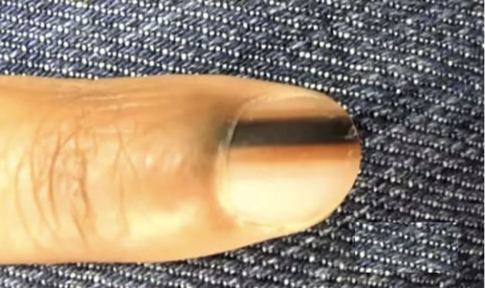 Warning If You See This Black Line On Your Nail Or Someone Else’s This