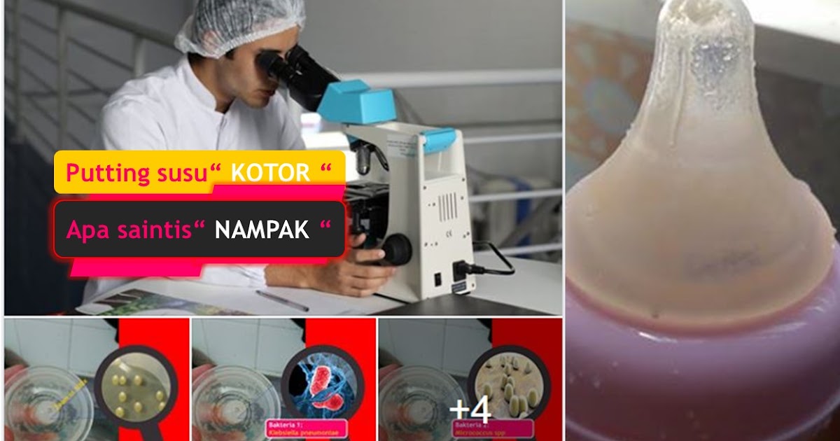 Puting susu kotor ? Tahu apa sanitis nampak dari microscope