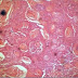 Research Proving Cannabis Kills Cancer Cells Safely has been Suppressed Since 1974
