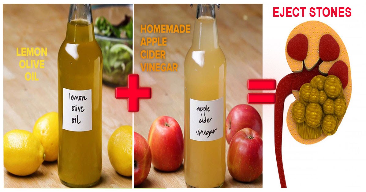 An Effective Recipe Based On Lemon To Dissolve Kidney Stones