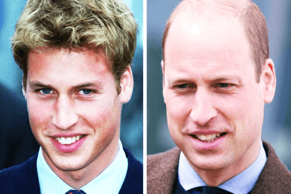 Prens William Gençlik Hâli Prens William Gençlik Hâli