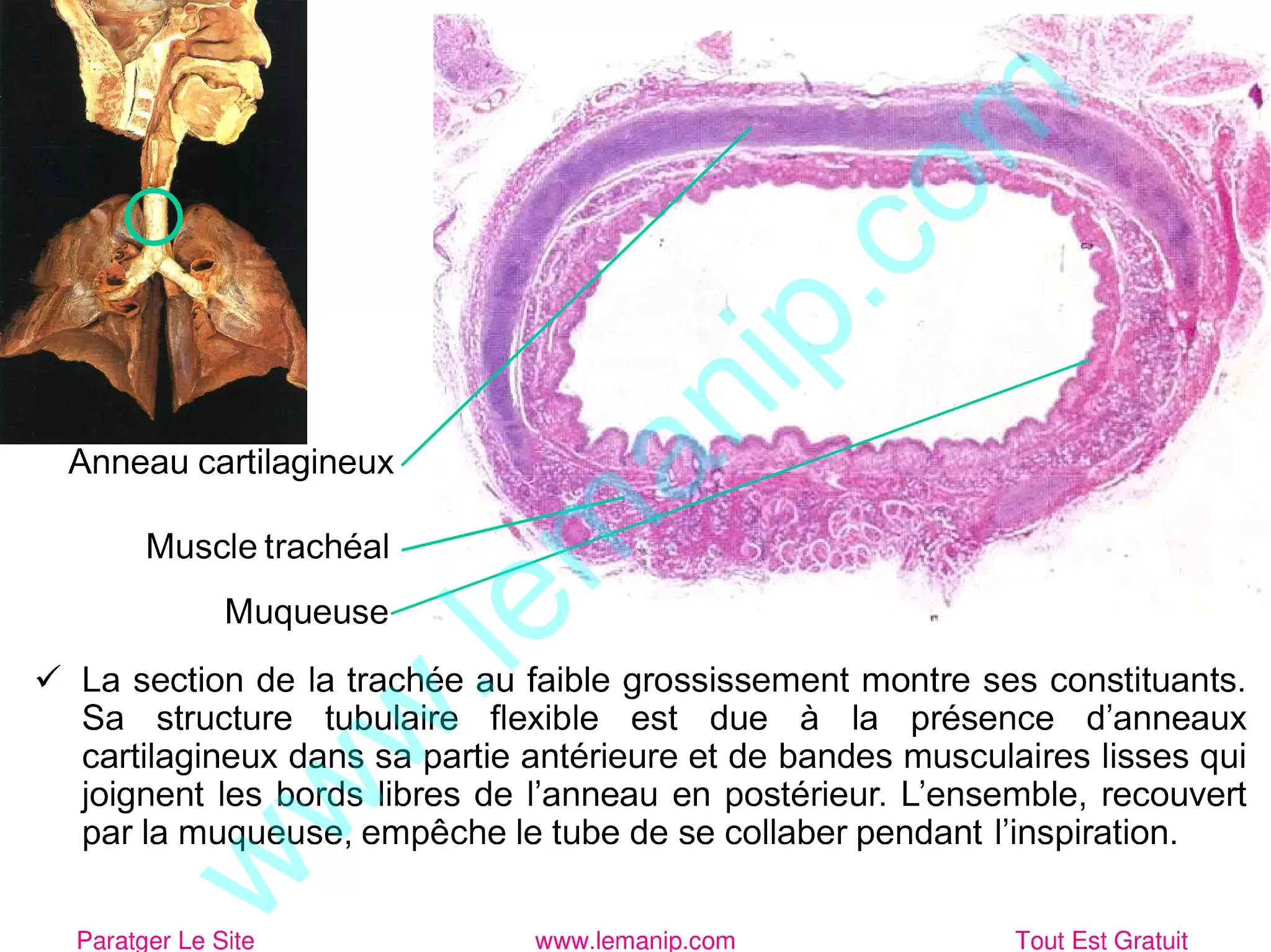 Muscle trachéal