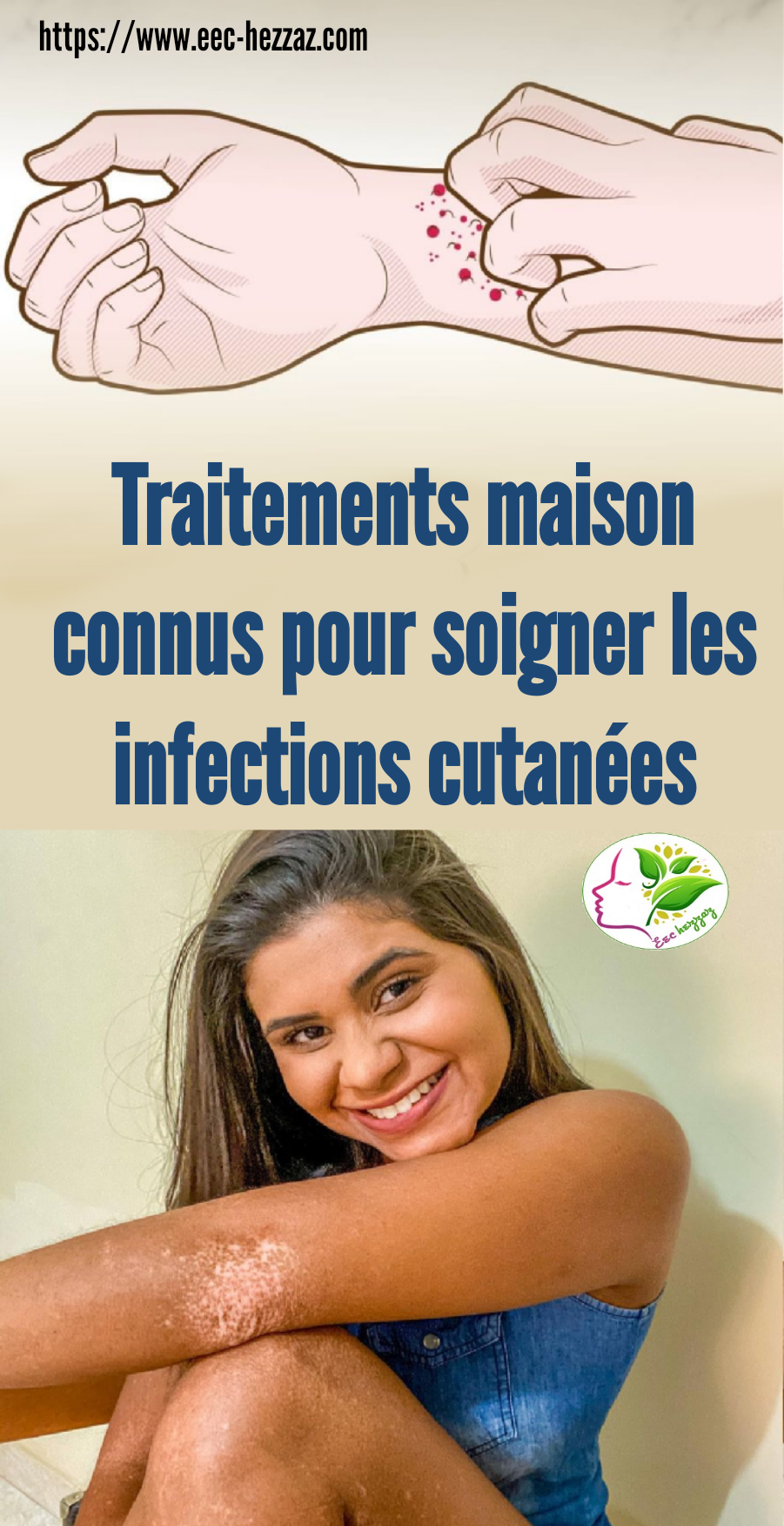 Traitements maison connus pour soigner les infections cutanées