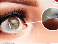 zooming contact lens
