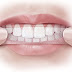 Miếng dán trắng răng có hiệu quả không?