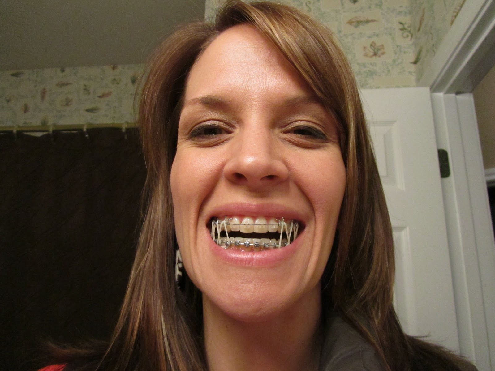 Stamps Postings Braces