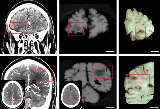 Al brain. Оцифровка мозга. Сканирование мозга друг Майкла. Мозг р28. Сканируют мозг с помощью шапки.