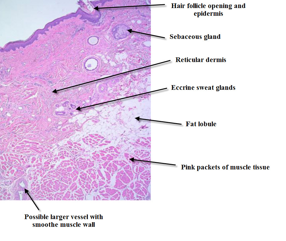 Dermatopathology Made Simple Inflammatory Introduction to skin