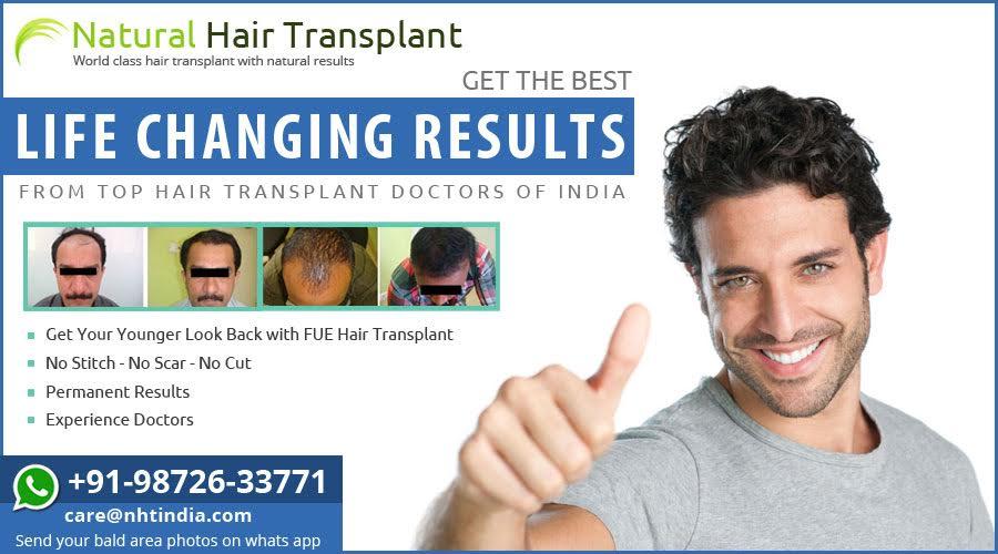 Natural Hair Transplant's Surgeries & Results