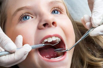 Niềng răng cho trẻ em ở độ tuổi nào là hiệu quả? 1