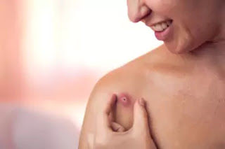 Scalp Folliculitis Treatment