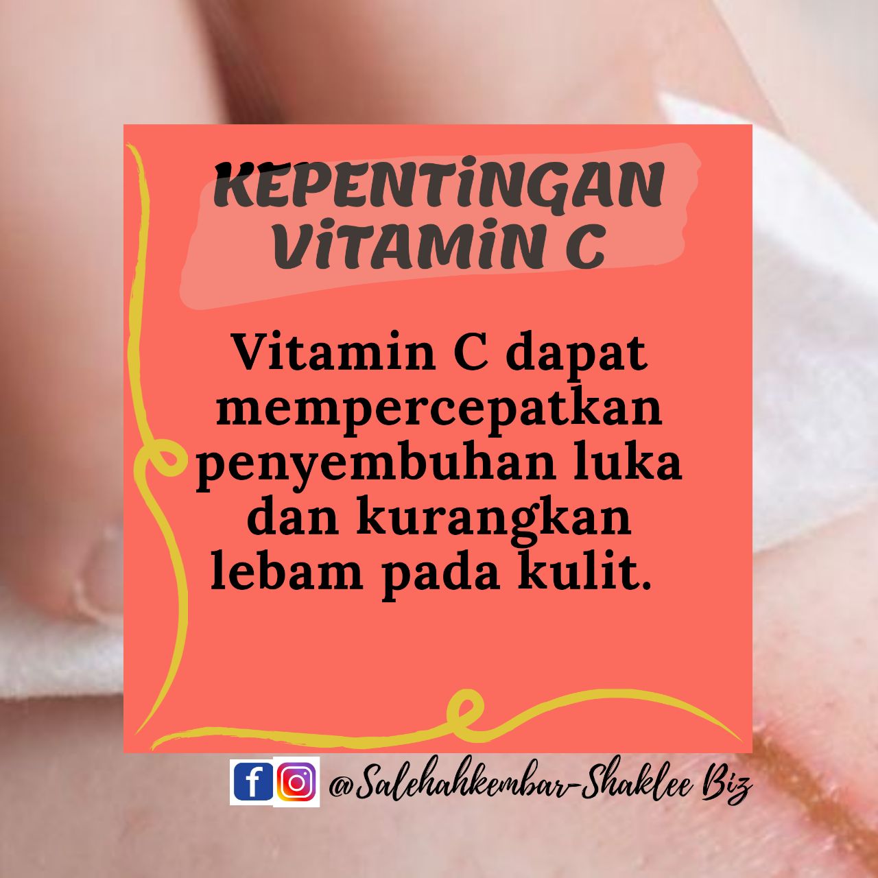 Kepentingan Vitamin C 