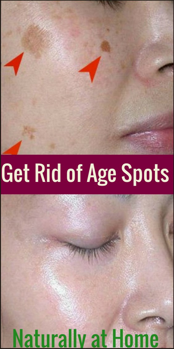 How To Get Rid of Age Spots Naturally at Home