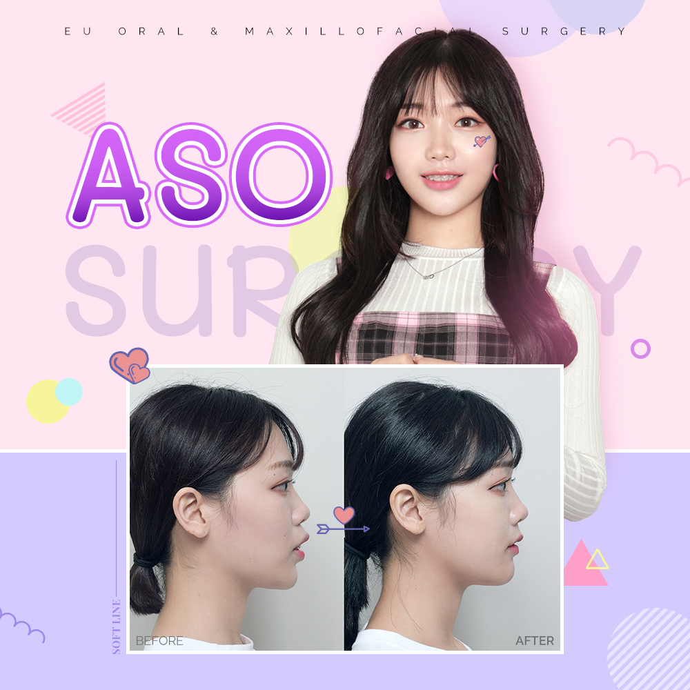 What is Protruding Mouth? What is ASO Surgery?