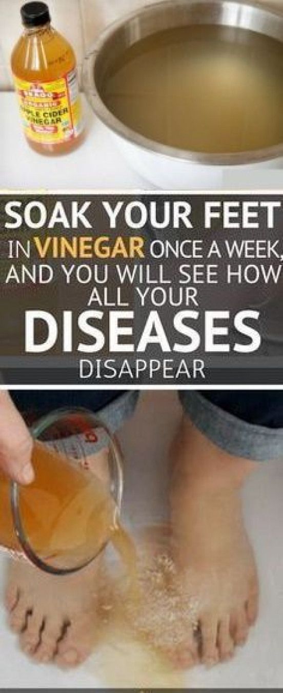 ACV Foot Soak Conditions It Helps With and How to Make One Wellness Count
