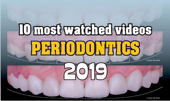10 most viewed PERIODONTICS videos in 2019