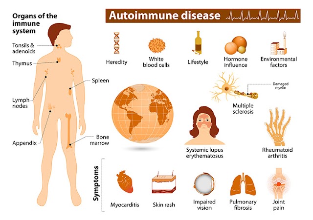 Autoimmune Disease List
