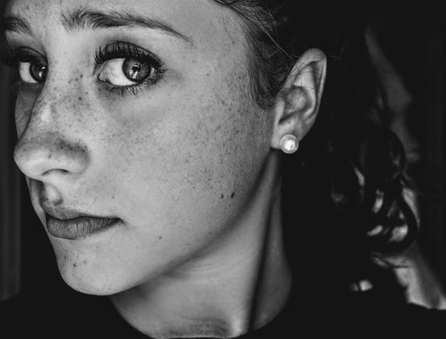 How To Get Rid Of Dark Spots With Home Remedies How To Get Rid Of Dark Spots With Home Remedies