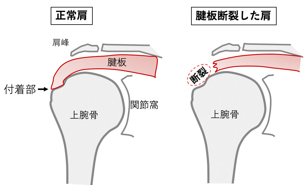 1. 出入り口のストレッチ