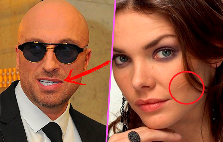 шрам на лице у боярской. лиза боярская нос. елизавета боярская фото со шрамом. елизавета боярская 2020 пластика. елизавета боярская до пластики носа.