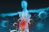 60 Jenis Istilah Medis Inflamasi (Peradangan) yang terjadi pada manusia