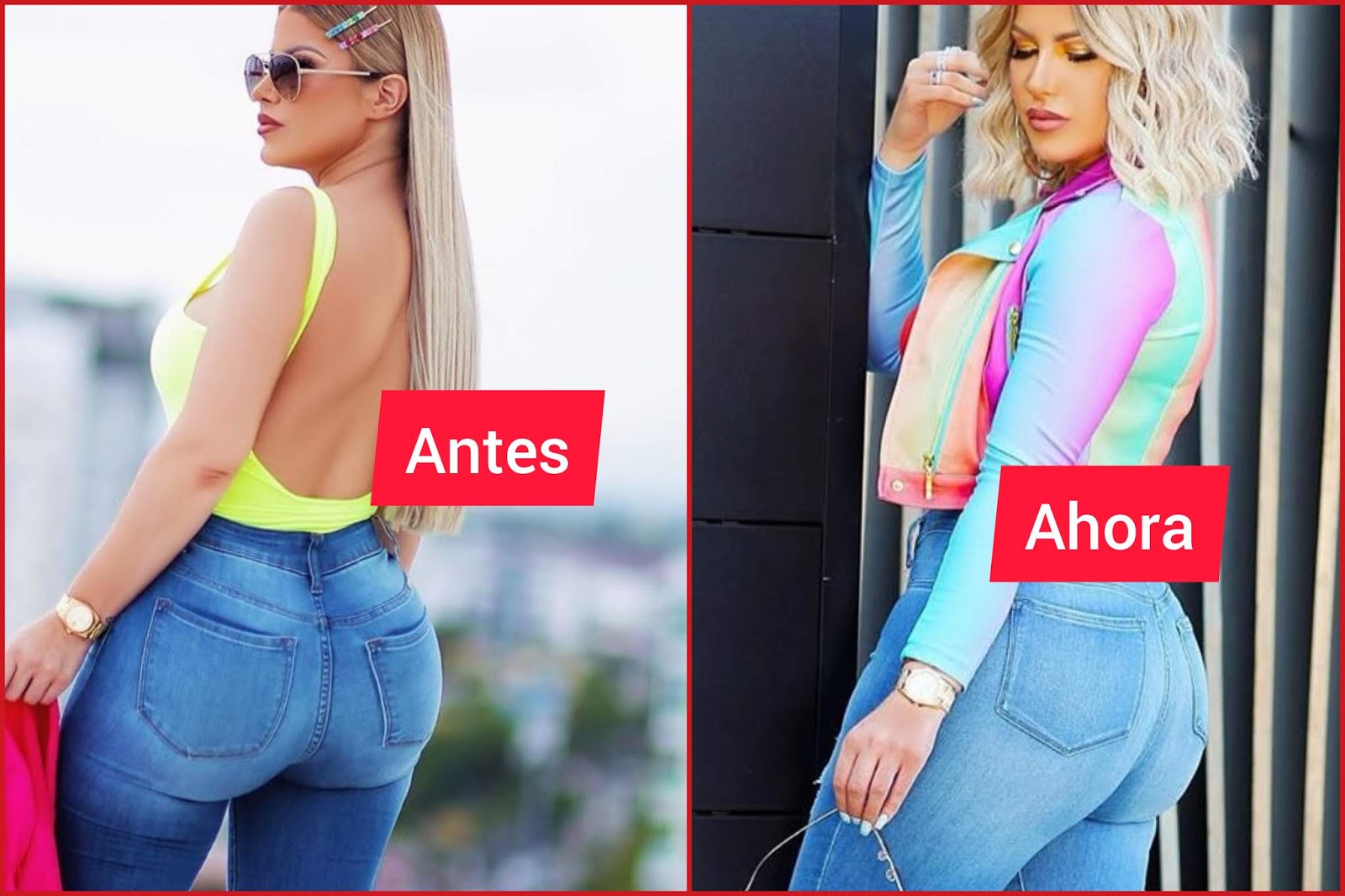 Así quedó Alexandra tras su operación en las pompis Al Paso de los