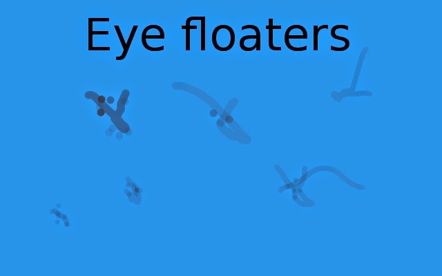 Floater