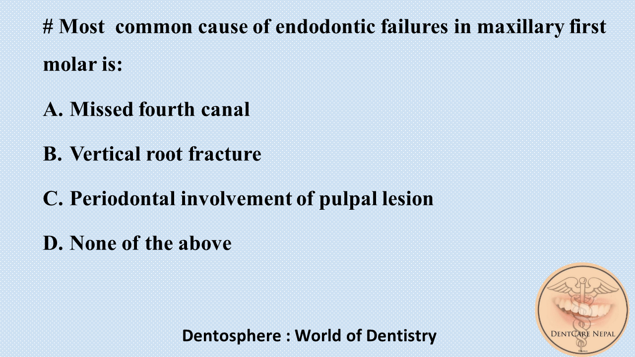 Dentosphere World of Dentistry Endodontic Failure in Maxillary First