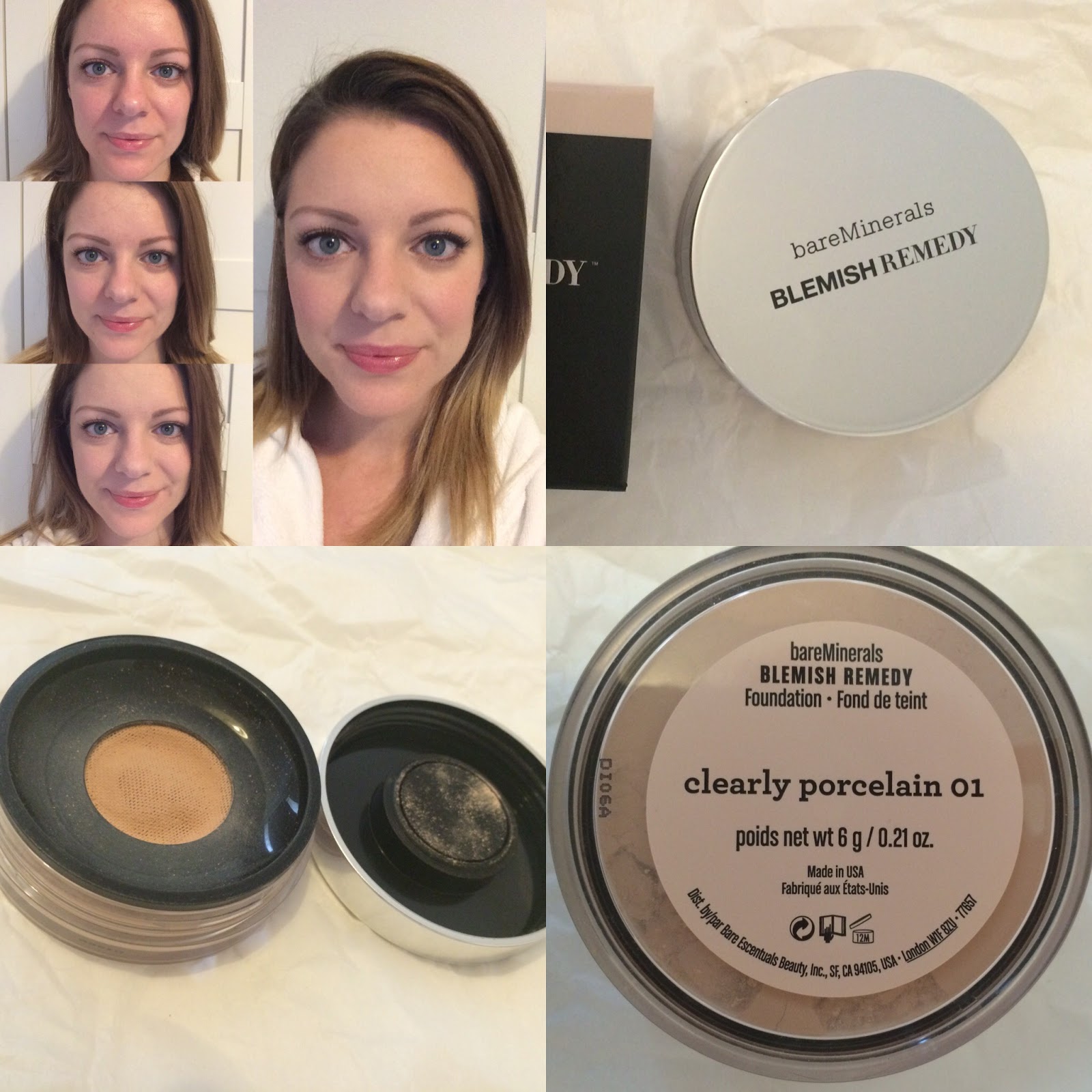 Arthurwears: Remedy Foundation | | Before and After