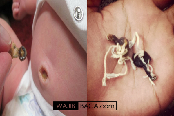 Bahaya Ghoib dan Spiritual Menyimpan Tali Pusar dan Menjadikannya Obat Bahaya Ghoib dan Spiritual Menyimpan Tali Pusar dan Menjadikannya Obat