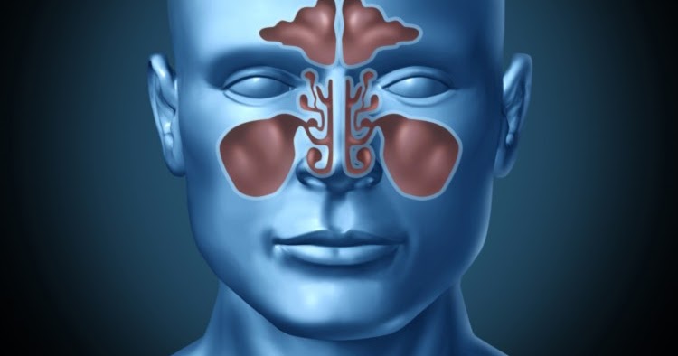 Sinüzit Belirtileri, Tanı ve Tedavisi Kadınlar Sitesi