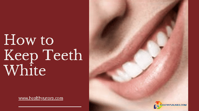 How to Keep Teeth White How to Keep Teeth White