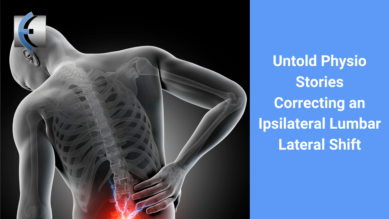 Untold Physio Stories - Correcting an Ipsilateral Lumbar Lateral Shift - themanualtherapist.com