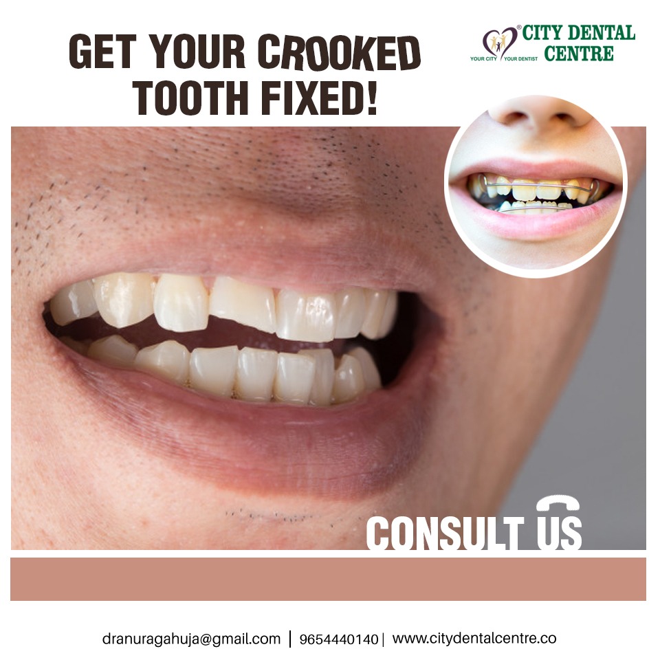 Get Best Dentist in Noida for Painless Treatment